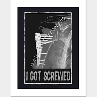 I Got Screwed - Humorous Fracture Posters and Art